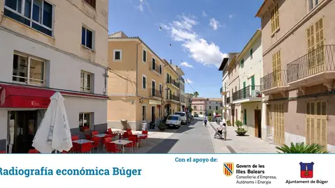 buger radiografia